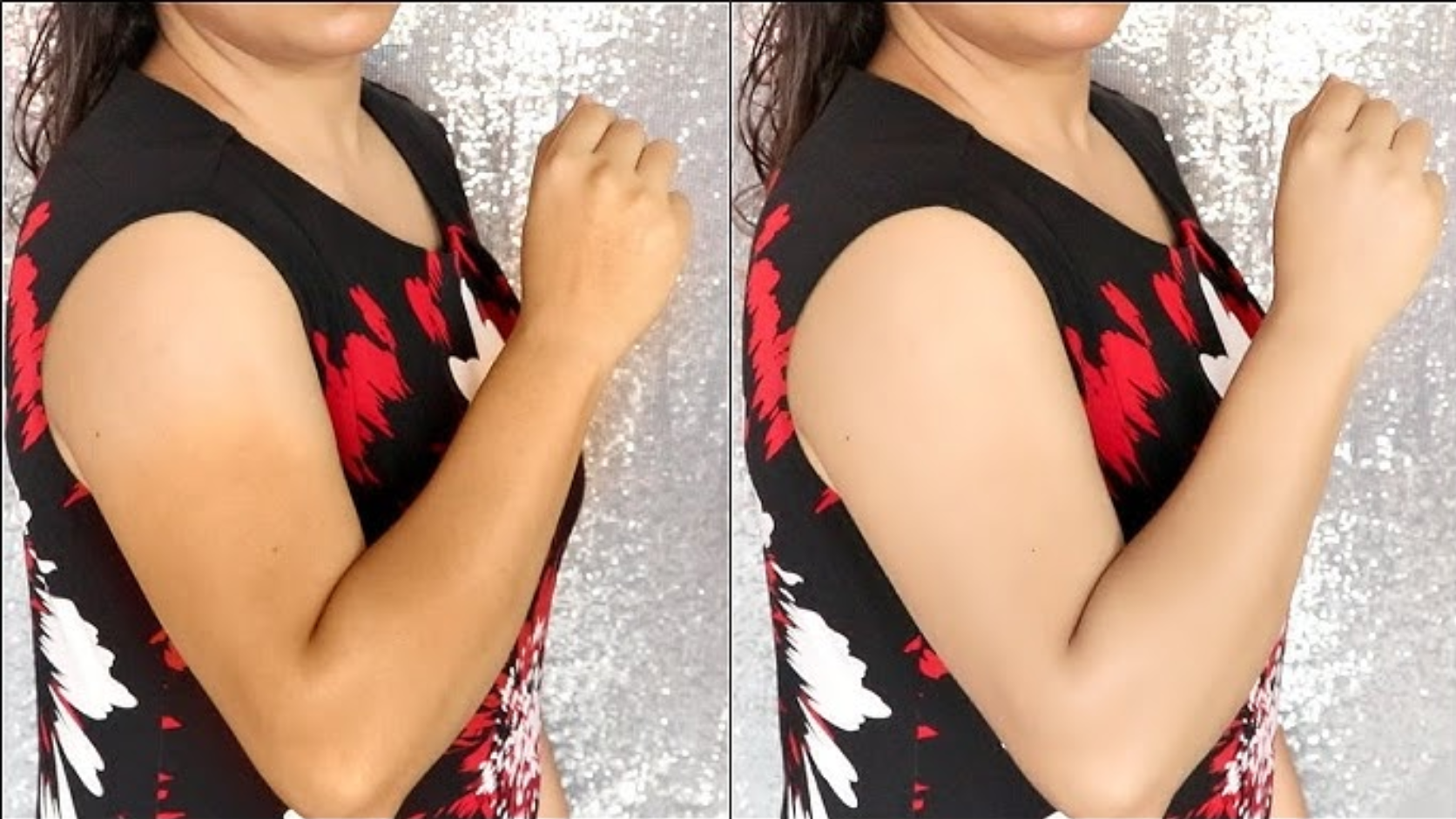 Arms Detan