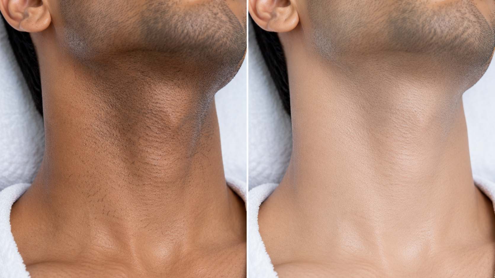 Neck Bleach